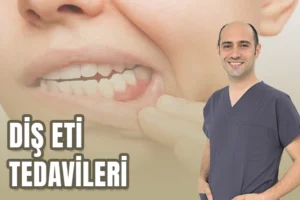 diş eti sorunları
