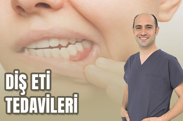 diş eti sorunları